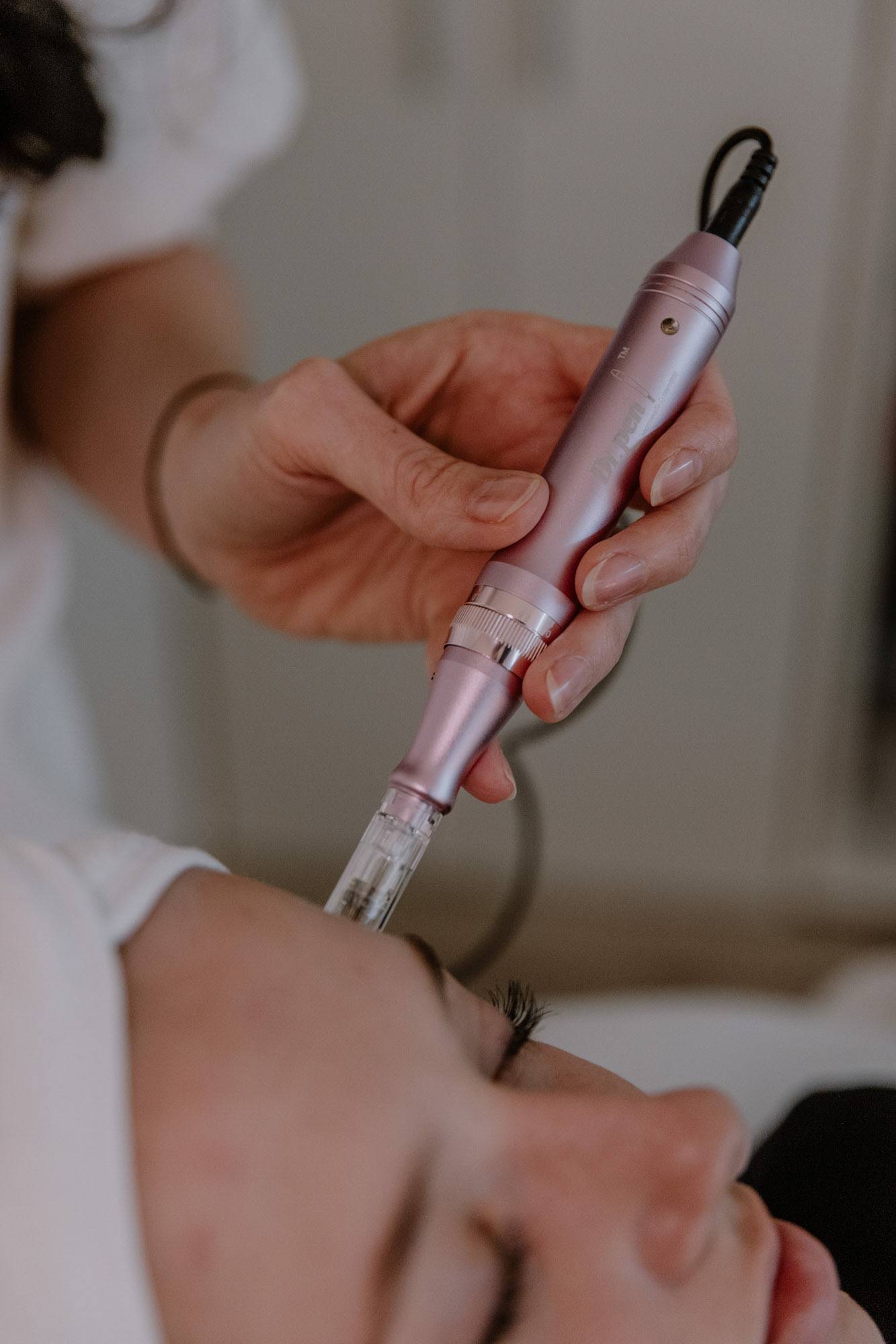 Kosmetisches Microneedling